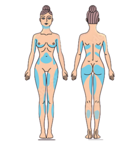 دستگاه-لاغری-موضعی-رشت